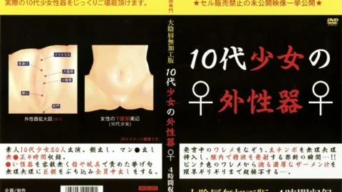 WCPL-001 External genitalia of a teenage girl
